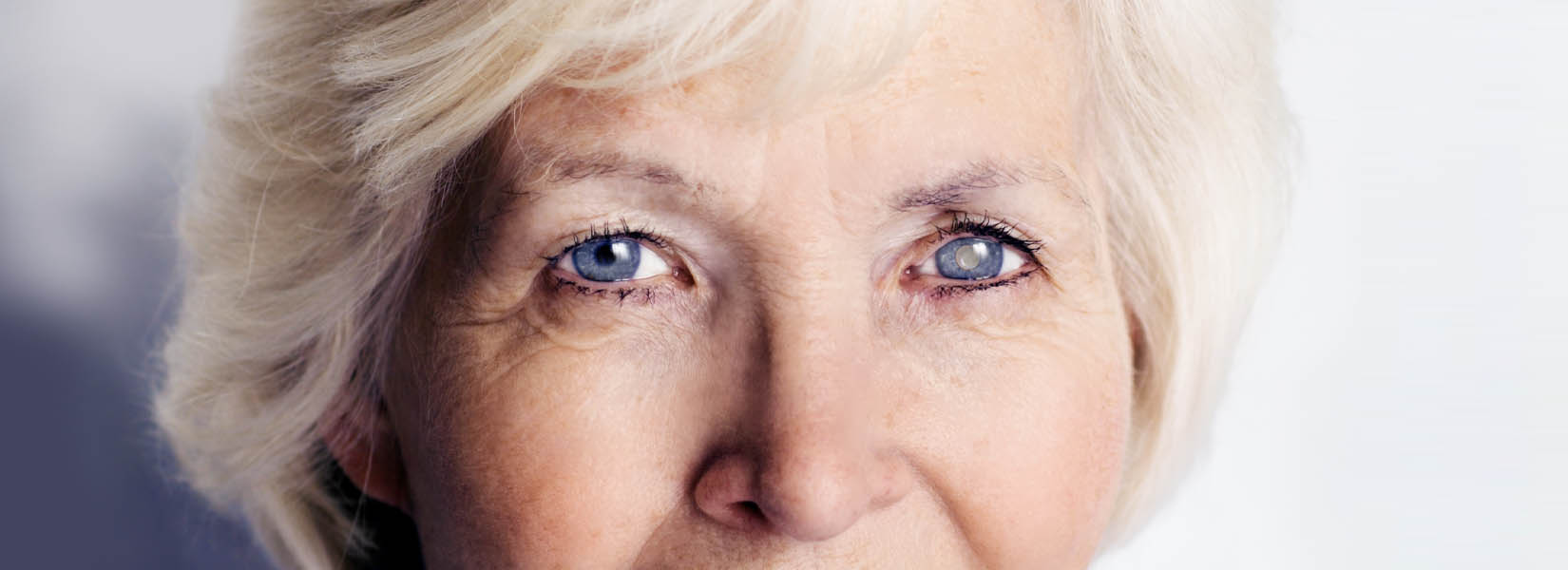 Cataract Surgery in Wentzville